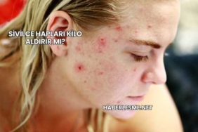 Sivilce Hapları Kilo Aldırır mı?